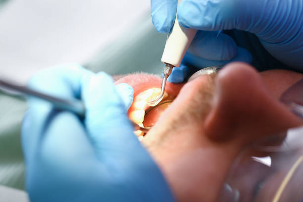 Best Tooth Pain Emergency Relief  in Upper Sandusky, OH